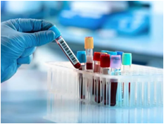 Blood Tests